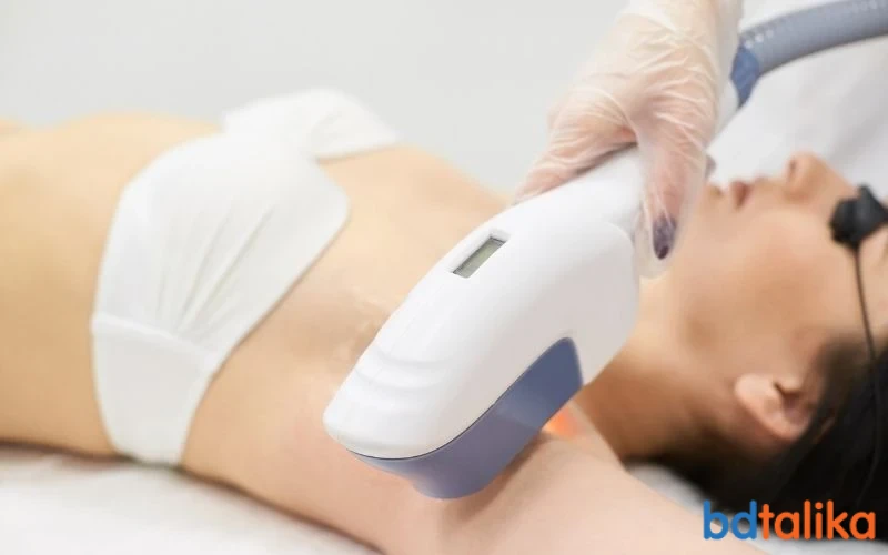 Laser Hair Removal